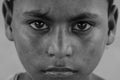 Closeup of a poor staring hungry orphan boy in a refugee camp with sad expression.