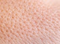 Closeup of porous oily human skin. Large pores on the skin, background, macro, cosmetology