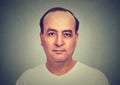 Closeup portrait headshot balding man Royalty Free Stock Photo