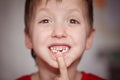 Closeup portrait Little happy boy proud to loose his milk tooth