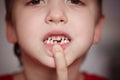 Closeup portrait Little happy boy proud to loose his milk tooth