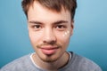 Closeup portrait of positive brunette man having spots of moisturizer cream under his eyes, applying facial treatment. indoor Royalty Free Stock Photo