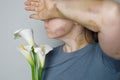 Closeup portrait of woman with car accident scar and bruise