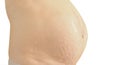 Closeup of a pregnant belly with stretch marks. Royalty Free Stock Photo