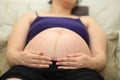 Closeup of pregnant woman belly with cracked skin Royalty Free Stock Photo