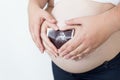 Closeup of pregnant woman and husband holding ultrasound fetus i Royalty Free Stock Photo