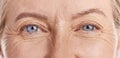 Closeup of senior woman, eyes and wrinkles with vision, skin with face and natural beauty. Anti aging, dermatology and