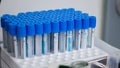 Closeup of several test tubes with blue caps put for analysis - concept of health