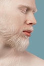 Closeup shot of bearded albino man with closed eyes, white hair and pale skin over turquoise studio background, crop Royalty Free Stock Photo