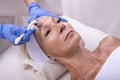 Closeup shot of a beautiful female in beauty salon during mesotherapy procedure with derma roller