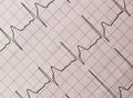 Closeup shot of the electrocardiogram of a heart Royalty Free Stock Photo