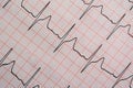Closeup shot of the electrocardiogram of a heart Royalty Free Stock Photo