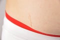 Strecht marks on my belly Royalty Free Stock Photo