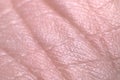 Closeup Skin 