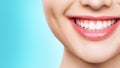 Closeup of smile with white healthy teeth. Royalty Free Stock Photo