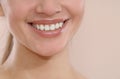 Closeup of smile with white healthy teeth Royalty Free Stock Photo