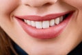 Closeup of smile with white healthy teeth.Teeth whitening. Dental care. Royalty Free Stock Photo