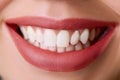 Closeup of smile with white healthy teeth.Teeth whitening. Dental care. Royalty Free Stock Photo