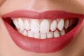 Closeup of smile with white healthy teeth.Teeth whitening. Dental care. Lips care. Royalty Free Stock Photo