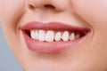 Closeup of smile with white healthy teeth.Teeth whitening. Dental care. Lips care. Royalty Free Stock Photo