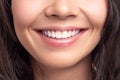 Closeup smile of young teen happy female woman great white teeth. Dental health. Royalty Free Stock Photo