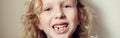 Closeup of smiling Caucasian blonde girl showing her missing lost milk tooth. Dental oral health hygiene. Stage of kids growing up Royalty Free Stock Photo