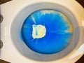 Closeup of toilet bowl seat with blue white environmantal harmful chemical chlorine aggressive cleaning detergent product