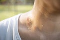 Closeup of wet female throat with water drops or sweat on skin,symptom of panic disorder, lymphoma or obesity, Sweaty asian woman