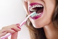 Closeup woman brushing teeth with braces Royalty Free Stock Photo