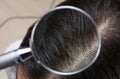 Closeup of woman with dandruff in her hair Royalty Free Stock Photo