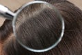 Closeup of woman with dandruff in her hair Royalty Free Stock Photo