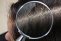 Closeup of woman with dandruff in her hair Royalty Free Stock Photo