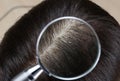 Closeup of woman with dandruff in her hair Royalty Free Stock Photo