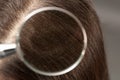 Closeup of woman with dandruff in her hair Royalty Free Stock Photo