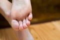 Closeup of woman feet sole with dry cracked skin. Foot and toes care concept Royalty Free Stock Photo