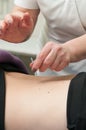 Closeup of a woman getting an acupuncture treatment