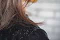 Closeup woman hair with dandruff falling on shoulders Royalty Free Stock Photo