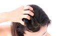 Closeup woman hand itchy scalp, Hair care Royalty Free Stock Photo