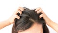 Closeup woman hand itchy scalp, Hair care Royalty Free Stock Photo