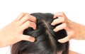 Closeup woman hand itchy scalp, Hair care Royalty Free Stock Photo