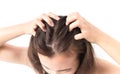 Closeup woman hand itchy scalp, Hair care Royalty Free Stock Photo