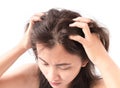 Closeup woman hand itchy scalp, Hair care