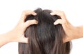 Closeup woman hand itchy scalp, Hair care Royalty Free Stock Photo