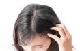 Closeup woman hand itchy scalp, Hair care Royalty Free Stock Photo