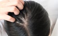 Closeup woman hand itchy scalp, Hair care concept. Royalty Free Stock Photo