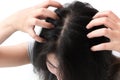 Closeup woman hand itchy scalp, Hair care concept Royalty Free Stock Photo