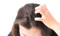 Closeup woman hand itchy scalp, Hair care concept Royalty Free Stock Photo