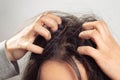 Closeup woman hand itchy scalp, Hair care concept Royalty Free Stock Photo