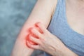 Woman hand scratching her arm skin itchy because of allergy