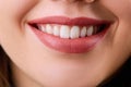 Closeup Woman smile. Teeth whitening. Dental care. Restoration concept. Lips Royalty Free Stock Photo